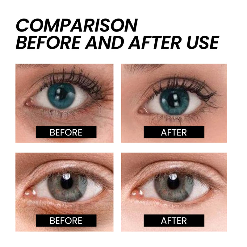 Firming Eye Cream Fading Wrinkle Eye Bags-zoom-
