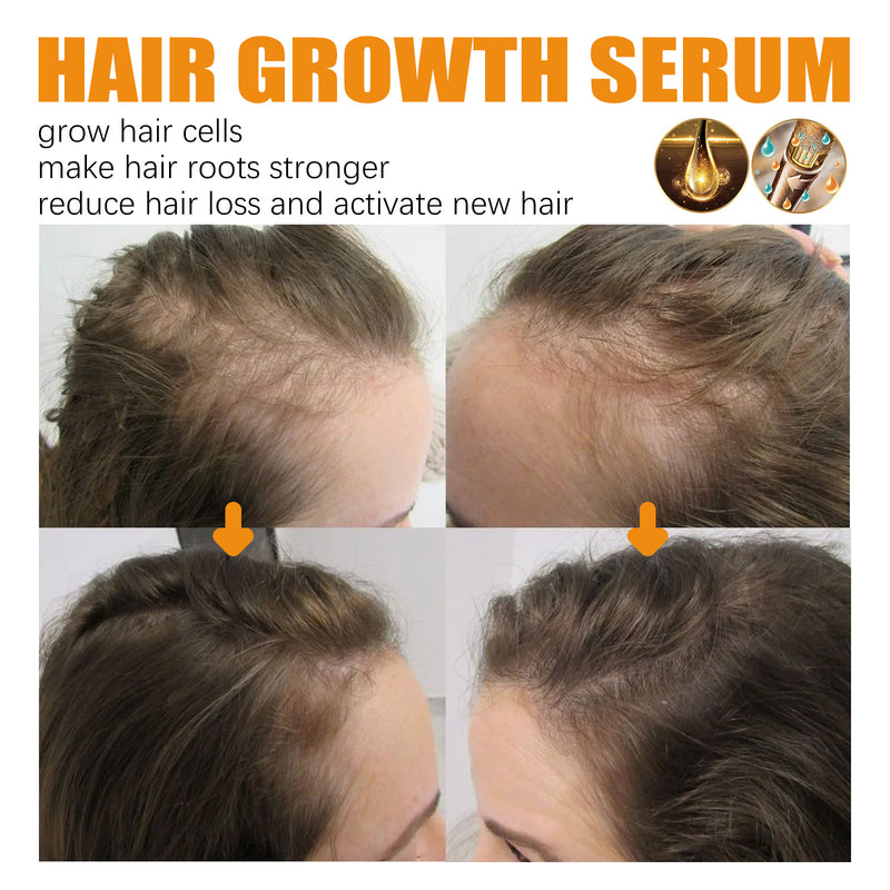 Hair Growth Repair Care Essential Oil-zoom-