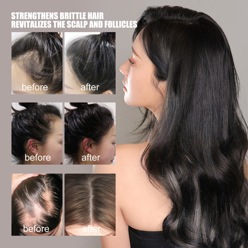 Hair Growth Repair Care Essential Oil-zoom-
